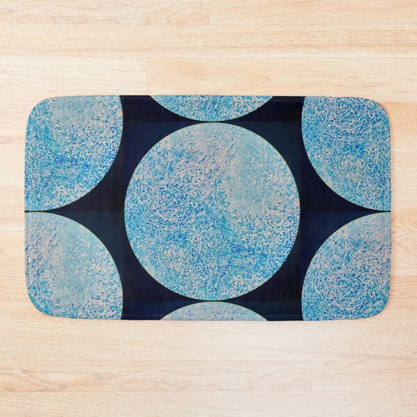 Item preview, Histology of Tuberculosis of the lung, TB, human tissue, Ziehl-Neelsen stain, 20x designed and sold by Psymier.