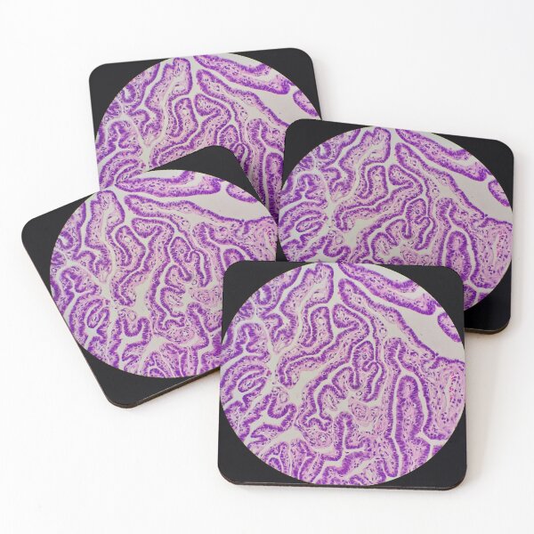 Item preview, Histology of Fallopian tube, human tissue, H&E, 100x designed and sold by Psymier.