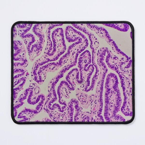 Item preview, Histology of Fallopian tube, human tissue, H&E, 100x designed and sold by Psymier.