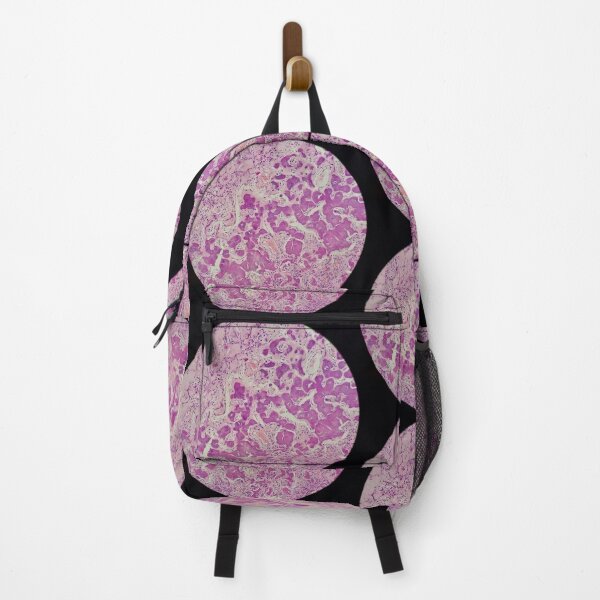 Item preview, Histology of coalescing psammomatous calcification, human tissue, H&E, 20x designed and sold by Psymier.