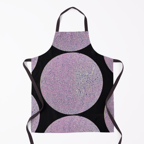 Item preview, Histology of fibrinopurulent exudate, pus, human tissue, H&E, 100x designed and sold by Psymier.