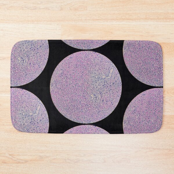 Item preview, Histology of fibrinopurulent exudate, pus, human tissue, H&E, 100x designed and sold by Psymier.