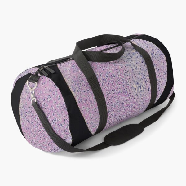 Item preview, Histology of fibrinopurulent exudate, pus, human tissue, H&E, 100x designed and sold by Psymier.