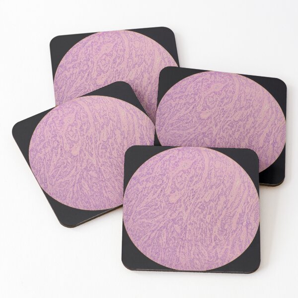 Item preview, Histology of spindle cell tumour, human tissue, H&E, 20x designed and sold by Psymier.