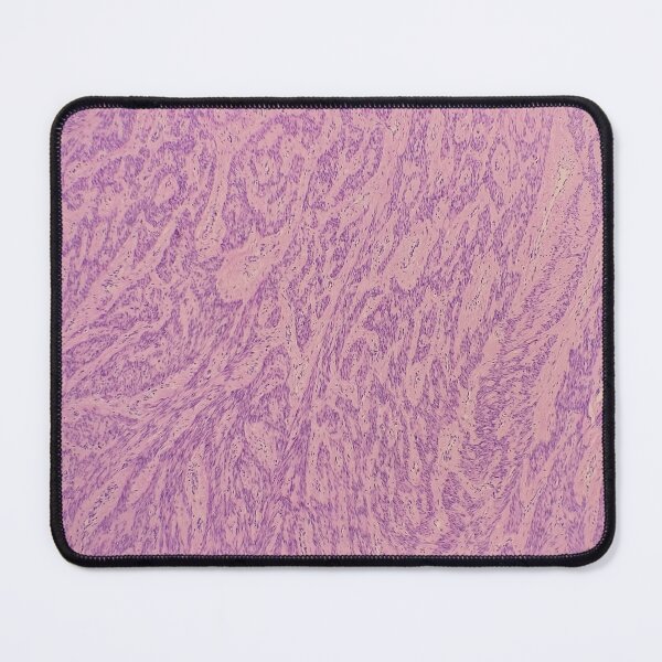 Item preview, Histology of spindle cell tumour, human tissue, H&E, 20x designed and sold by Psymier.