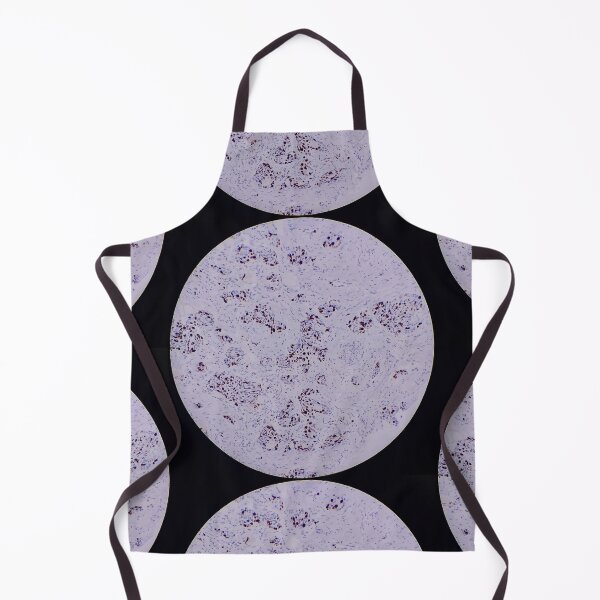Item preview, Histology of breast cancer, human tissue, Ki67 immunohistochemistry, 40x designed and sold by Psymier.