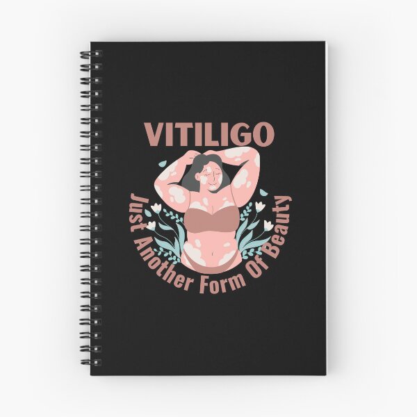 Item preview, Vitiligo Just Another Form Of Beauty Female Model designed and sold by MimsTees.