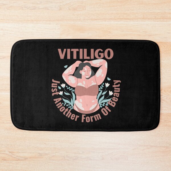 Item preview, Vitiligo Just Another Form Of Beauty Female Model designed and sold by MimsTees.