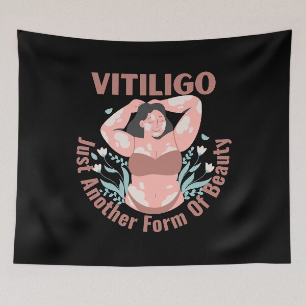 Item preview, Vitiligo Just Another Form Of Beauty Female Model designed and sold by MimsTees.
