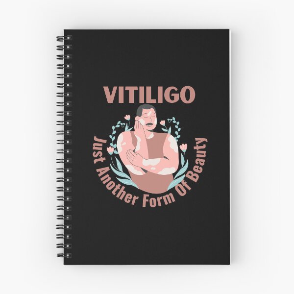 Item preview, Vitiligo Just Another Form Of Beauty Male Model designed and sold by MimsTees.