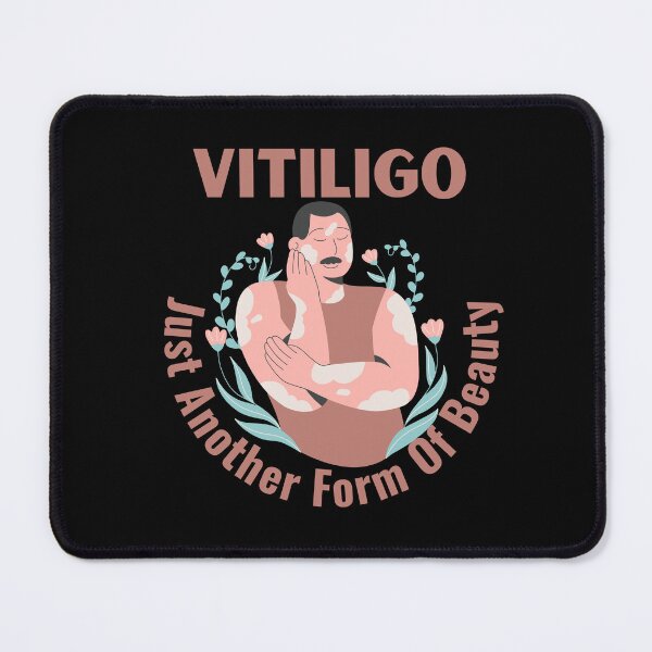 Item preview, Vitiligo Just Another Form Of Beauty Male Model designed and sold by MimsTees.