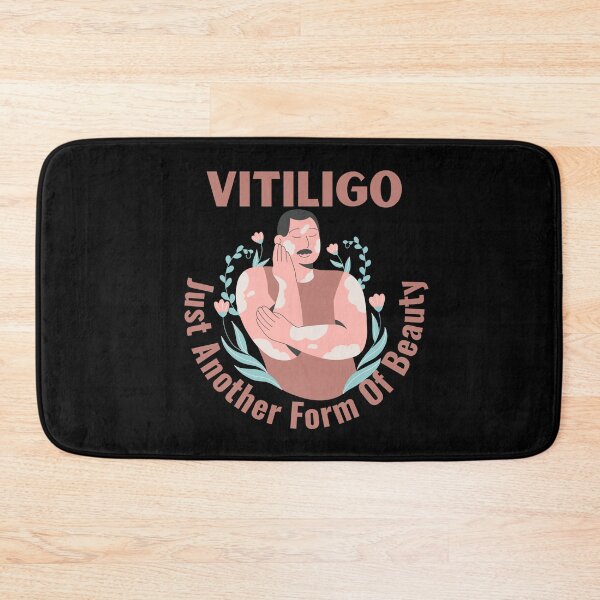 Item preview, Vitiligo Just Another Form Of Beauty Male Model designed and sold by MimsTees.