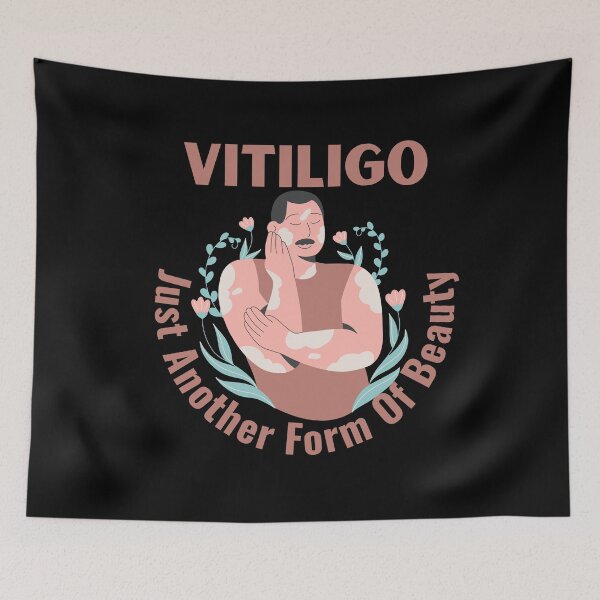 Item preview, Vitiligo Just Another Form Of Beauty Male Model designed and sold by MimsTees.