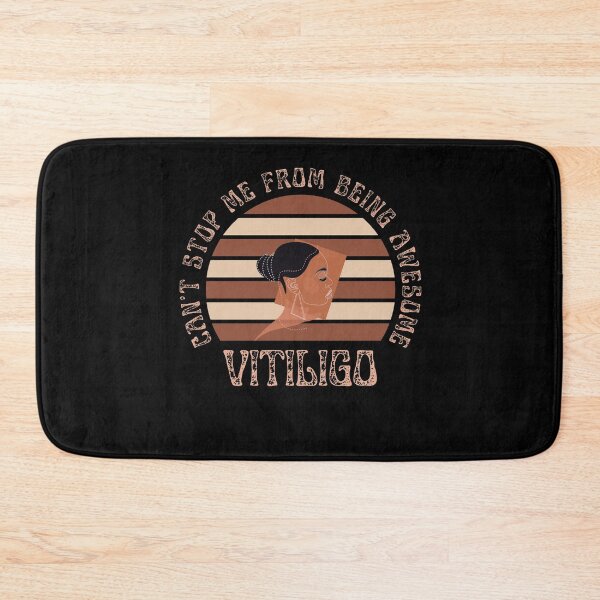 Item preview, Vitiligo Can't Stop Me From Being Awesome Sunset Background Female Model designed and sold by MimsTees.