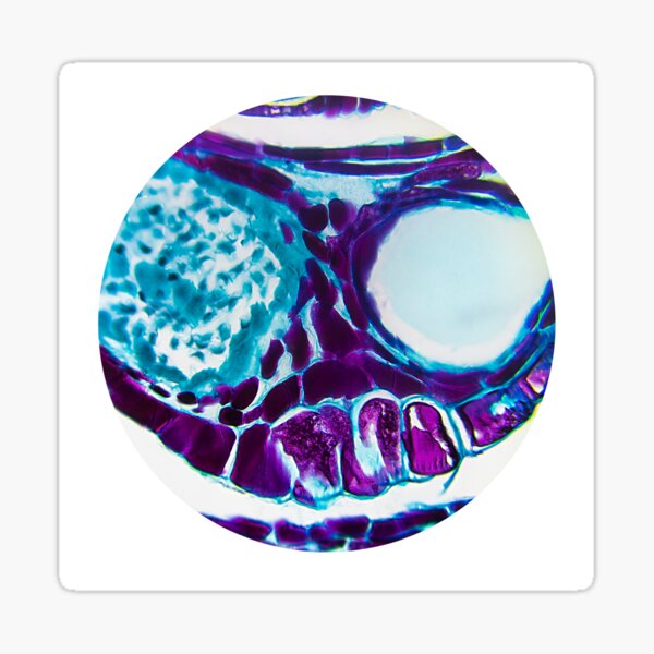 Pinophyta6 - Pine Cone - Microscopy Photograph Sticker