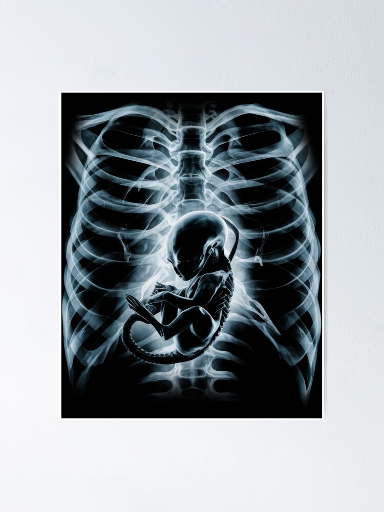 Alien radiography, Alien X-ray