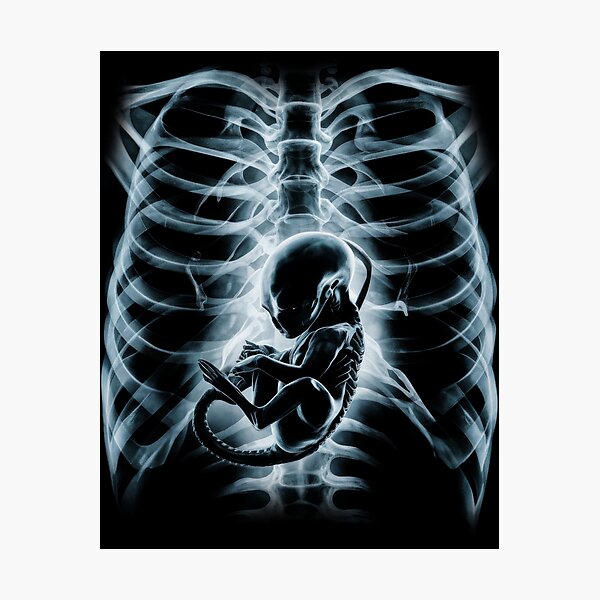 Alien radiography, Alien X-ray