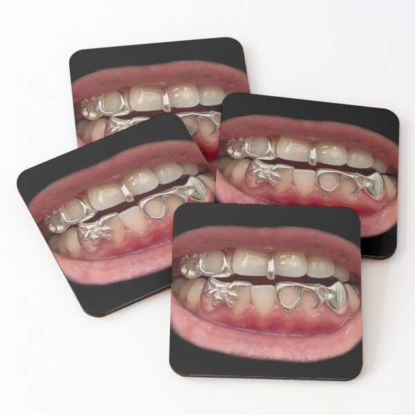 Item preview, Grillz designed and sold by studioiris.