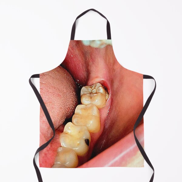 Item preview, Wisdom Tooth designed and sold by ontological.