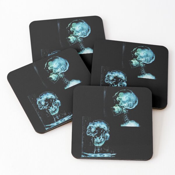 Item preview, Fungus Infection X Rays designed and sold by bilaaledits.