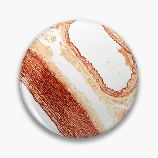 Item preview, Elastic artery and muscular artery designed and sold by Love Histology.