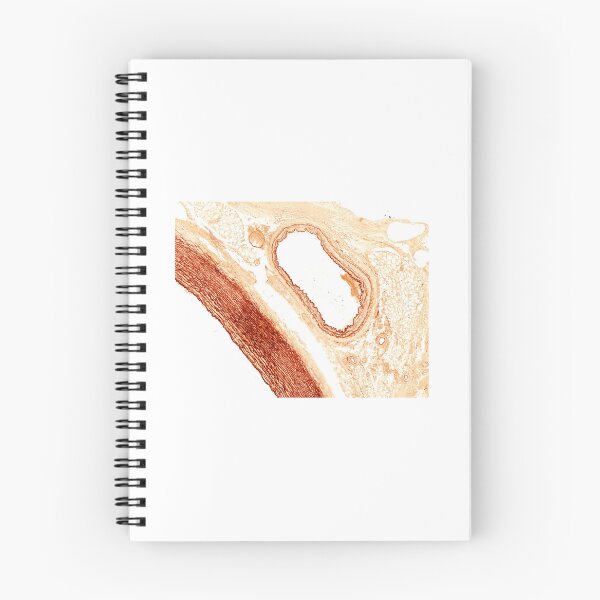 Item preview, Elastic artery and muscular artery designed and sold by Love Histology.
