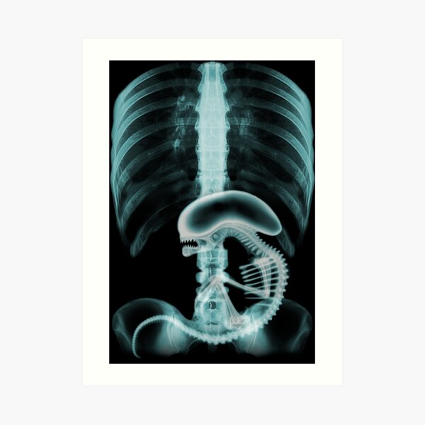 Alien radiography v2, Alien X-ray v2, blue