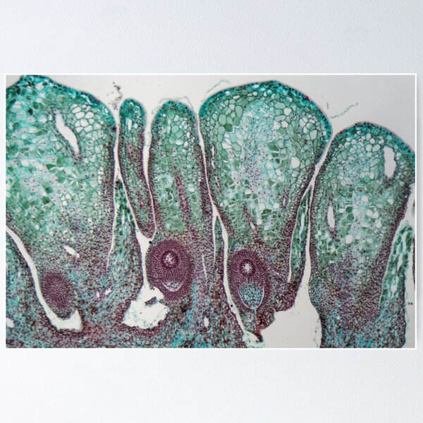 Item preview, Female pine cone under the microscope designed and sold by Zosimus.