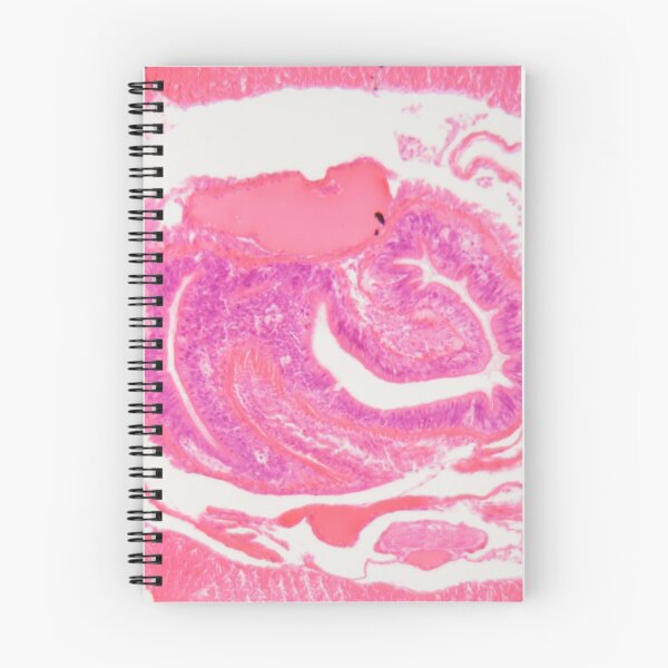 Item preview, Section of an Earthworm under the microscope designed and sold by Zosimus.