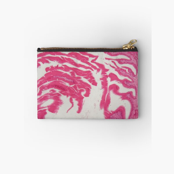 Item preview, Hydatide cyst of cyclophyllid tapeworm (Echinococcus) designed and sold by Zosimus.