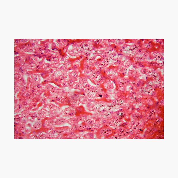 Item preview, Liver cells under the microscope designed and sold by Zosimus.