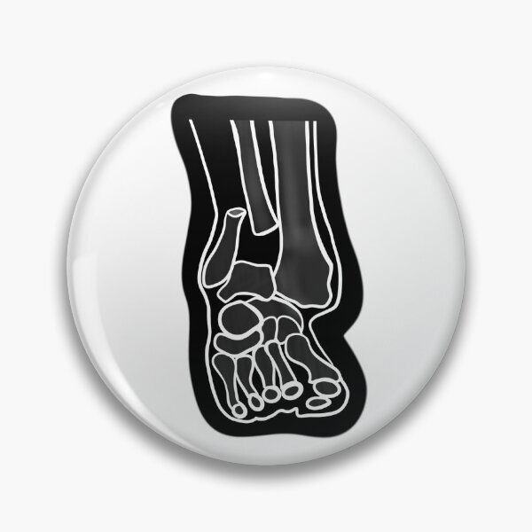 Item preview, Broken Ankle designed and sold by Lilbluey.