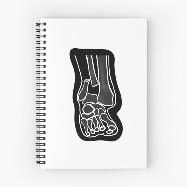 Item preview, Broken Ankle designed and sold by Lilbluey.