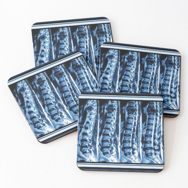 Item preview, Spine Scan designed and sold by KidaDiNicchi.