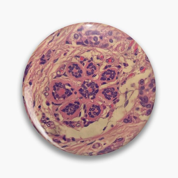Item preview, Breast flower duct histology designed and sold by CellPathWorld.