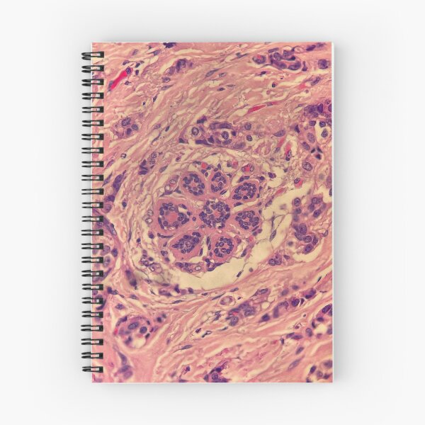 Item preview, Breast flower duct histology designed and sold by CellPathWorld.