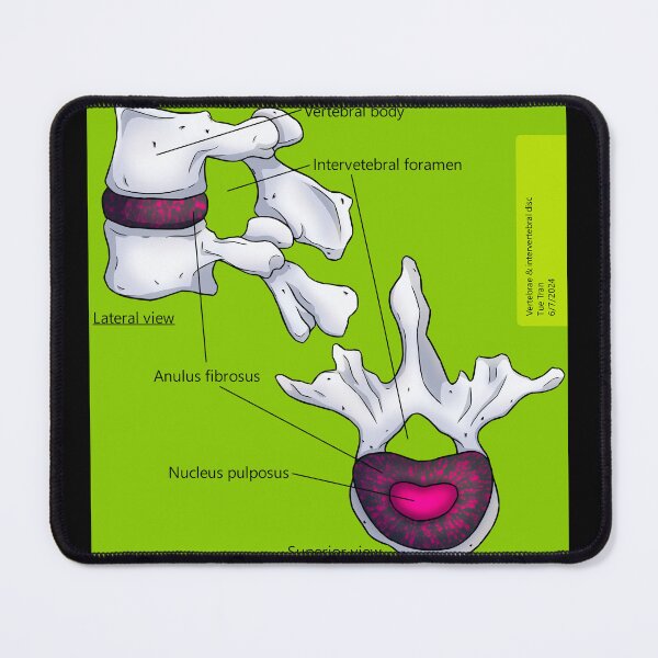 Item preview, Intevebral Disc (Green + Pink Splatter) Anatomy designed and sold by TueTran.