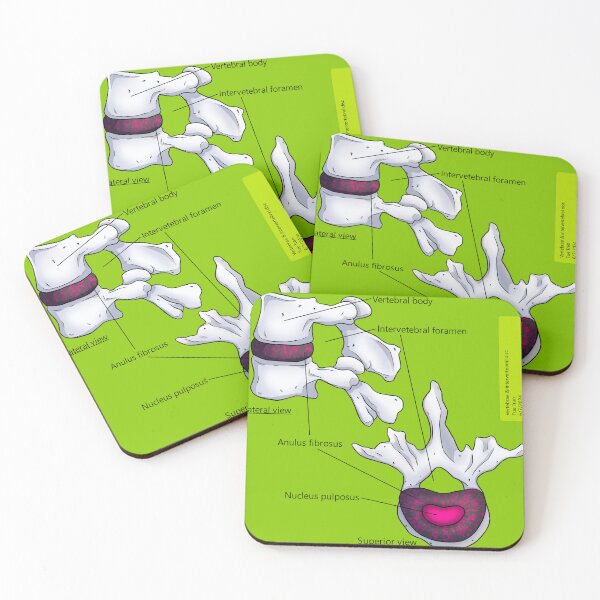 Item preview, Intevebral Disc (Green + Pink Splatter) Anatomy designed and sold by TueTran.