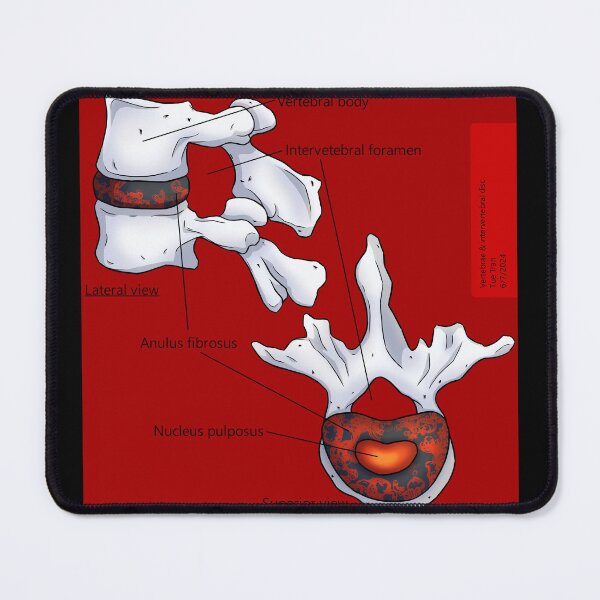 Item preview, Intevebral Disc (Red) Anatomy designed and sold by TueTran.