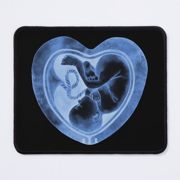 Item preview, Watercolor fetus inside the heart shaped womb designed and sold by Ekaterina Glazkova.