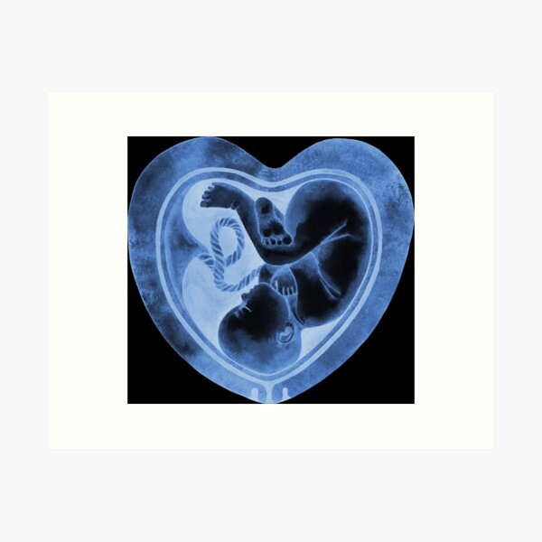 Item preview, Watercolor fetus inside the heart shaped womb designed and sold by Ekaterina Glazkova.