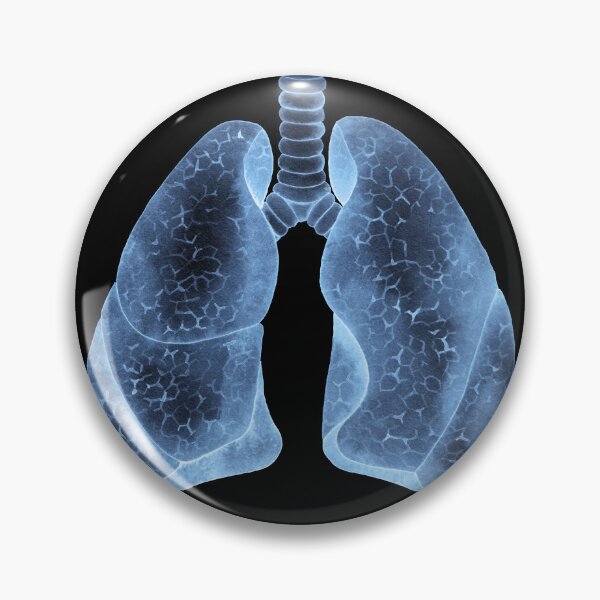 Item preview, X-rays of lungs designed and sold by Ekaterina Glazkova.