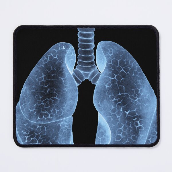 Item preview, X-rays of lungs designed and sold by Ekaterina Glazkova.