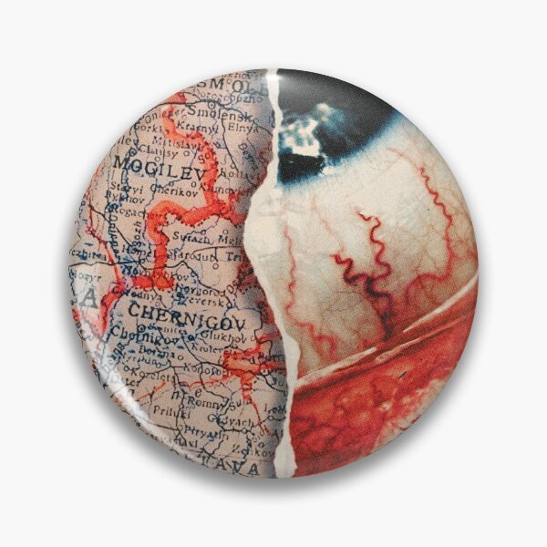 Item preview, Episcleritis designed and sold by Nielspmph.