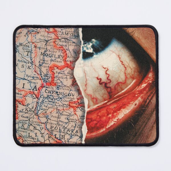 Item preview, Episcleritis designed and sold by Nielspmph.