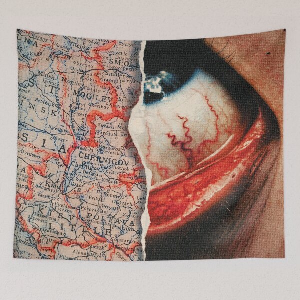 Item preview, Episcleritis designed and sold by Nielspmph.