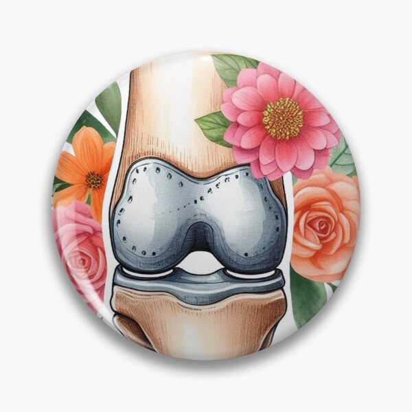 Item preview, Knee Replacement designed and sold by clintang.