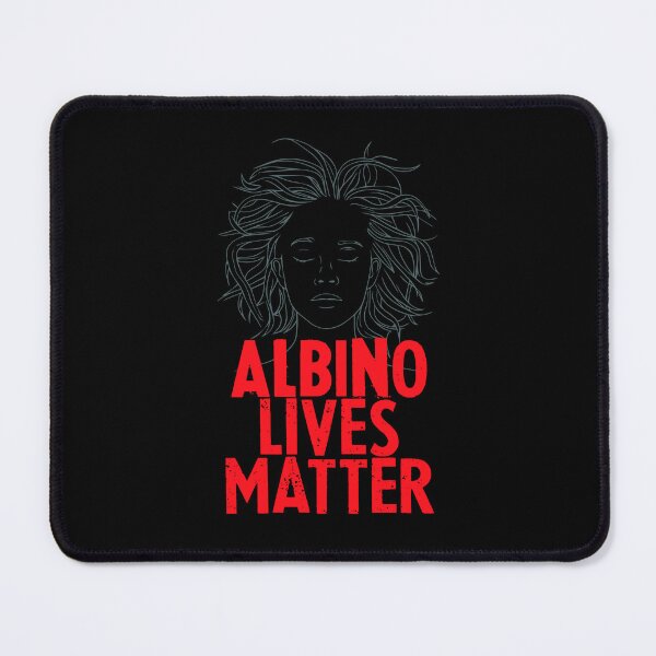 Item preview, Albino x albinism designed and sold by The Knick Knack Nook.