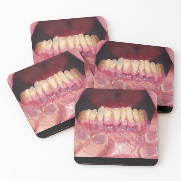 Item preview, Gums designed and sold by Zombiefatal88.