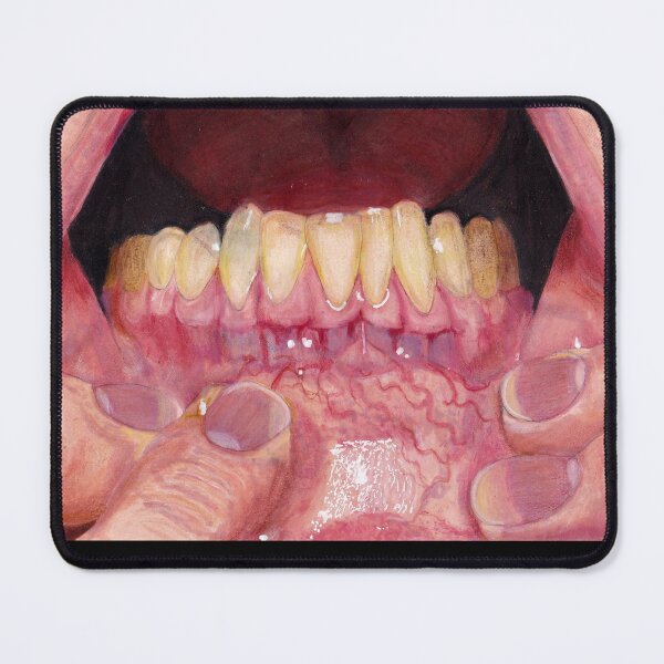 Item preview, Gums designed and sold by Zombiefatal88.